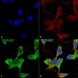 Invitrogen KCNK3 Monoclonal Antibody (N374/48), FITC 100 &mu;g; FITC:Antibodies,