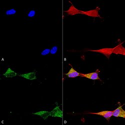 Invitrogen Ataxin 1 Monoclonal Antibody (N65/37), PE 100 &mu;g; PE:Antibodies,