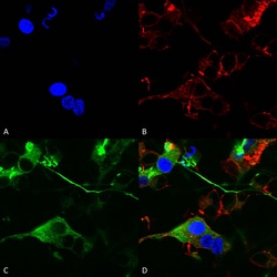 Invitrogen GABRA2 Monoclonal Antibody (N399/19), FITC 100 &mu;g; FITC:Antibodies,