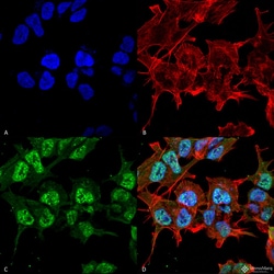 Invitrogen GABRA2 Monoclonal Antibody (N399/19), PerCP 100 &mu;g; PerCP:Antibodies,