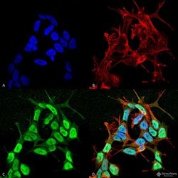 Invitrogen SCN3B Monoclonal Antibody (N396/29), FITC 100 &mu;g; FITC:Antibodies,