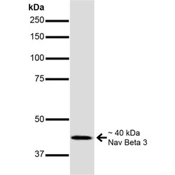 Invitrogen SCN3B Monoclonal Antibody (N396/29), FITC 100 &mu;g; FITC:Antibodies,