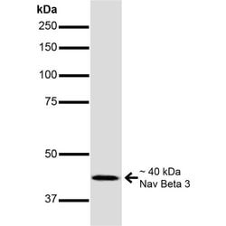 Invitrogen SCN3B Monoclonal Antibody (N396/29), PerCP 100 &mu;g | Buy Online | Invitrogen&trade; | Fisher Scientific