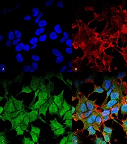 Invitrogen Kir6.1 (KCNJ8) Monoclonal Antibody (N366/60), PE 100 &mu;g;