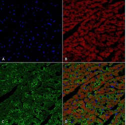 Invitrogen Hexanoyl-Lysine adduct Monoclonal Antibody (5D9), APC 100 &mu;g;