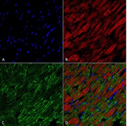 Invitrogen Hexanoyl-Lysine adduct Monoclonal Antibody (5E8), APC 100 &mu;g | Buy Online | Invitrogen&trade; | Fisher Scientific