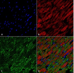 Invitrogen Hexanoyl-Lysine adduct Monoclonal Antibody (5E8), PE 100 &mu;g;