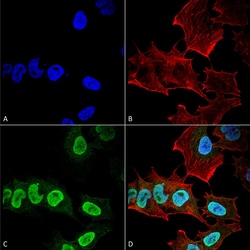 Invitrogen alpha Synuclein Monoclonal Antibody (10H7), FITC 100 &mu;g;