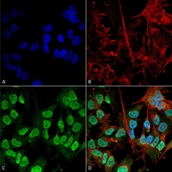 Invitrogen alpha Synuclein Monoclonal Antibody (3F8), APC 100 &mu;g | Buy Online | Invitrogen&trade; | Fisher Scientific