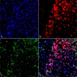 Invitrogen alpha Synuclein Monoclonal Antibody (3F8), PerCP 100 &mu;g;