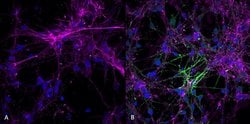 Invitrogen Phospho-alpha Synuclein (Ser129) Recombinant Rabbit Monoclonal