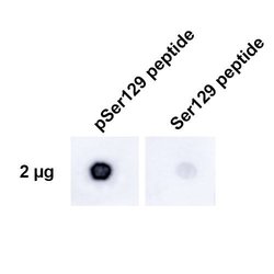 Invitrogen Phospho-alpha Synuclein (Ser129) Recombinant Rabbit Monoclonal