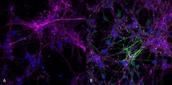 Invitrogen Phospho-alpha Synuclein (Ser129) Recombinant Rabbit Monoclonal