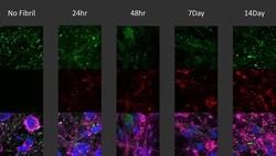 Invitrogen Phospho-alpha Synuclein (Ser129) Recombinant Rabbit Monoclonal