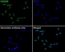 Invitrogen JMJD1B Recombinant Rabbit Monoclonal Antibody (PSH0-11) 100