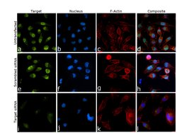 Invitrogen JMJD1B Recombinant Rabbit Monoclonal Antibody (PSH0-11) 100