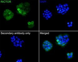 Invitrogen RICTOR Recombinant Rabbit Monoclonal Antibody (1D5) 100 &mu;L;