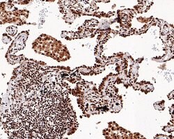 Invitrogen SETD1A Recombinant Rabbit Monoclonal Antibody (PH00-01) 100