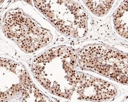 Invitrogen SETD1A Recombinant Rabbit Monoclonal Antibody (PH00-01) 100