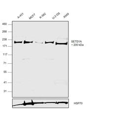 Invitrogen SETD1A Recombinant Rabbit Monoclonal Antibody (PH00-01) 100