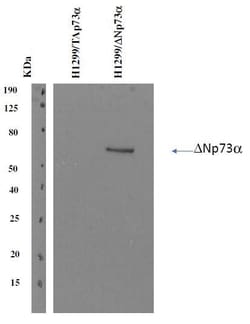 Invitrogen p73 delta Monoclonal Antibody (DNp73-1.1) 100 &mu;g; Unconjugated:Antibodies,