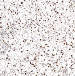 Invitrogen TFE3 Monoclonal Antibody (CL12810) 100 &mu;L; Unconjugated:Antibodies,