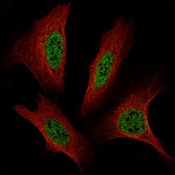 Invitrogen TFE3 Monoclonal Antibody (CL12822) 100 &mu;L; Unconjugated:Antibodies,