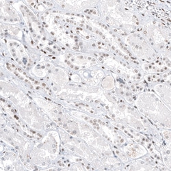 Invitrogen TFE3 Monoclonal Antibody (CL12822) 100 &mu;L; Unconjugated:Antibodies,