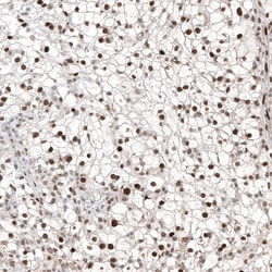 Invitrogen TFE3 Monoclonal Antibody (CL12822) 100 &mu;L; Unconjugated:Antibodies,