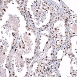 Invitrogen TFE3 Monoclonal Antibody (CL12822) 100 &mu;L; Unconjugated:Antibodies,