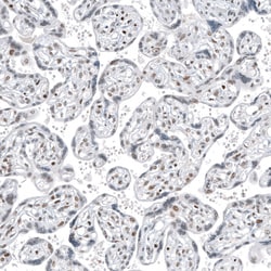 Invitrogen TFE3 Monoclonal Antibody (CL12822) 100 &mu;L; Unconjugated:Antibodies,