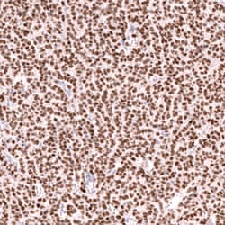 Invitrogen FOXL2 Monoclonal Antibody (CL12753) 100 &mu;L; Unconjugated:Antibodies,