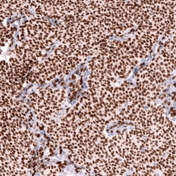 Invitrogen FOXL2 Monoclonal Antibody (CL12753) 100 &mu;L; Unconjugated:Antibodies,