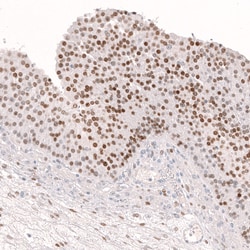Invitrogen FOXL2 Monoclonal Antibody (CL12753) 100 &mu;L; Unconjugated:Antibodies,