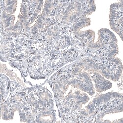 Invitrogen FOXL2 Monoclonal Antibody (CL12762) 100 &mu;L; Unconjugated:Antibodies,