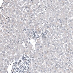 Invitrogen FOXL2 Monoclonal Antibody (CL12762) 100 &mu;L; Unconjugated:Antibodies,