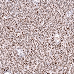 Invitrogen FOXL2 Monoclonal Antibody (CL12762) 100 &mu;L; Unconjugated:Antibodies,