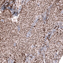 Invitrogen FOXL2 Monoclonal Antibody (CL12762) 100 &mu;L; Unconjugated:Antibodies,