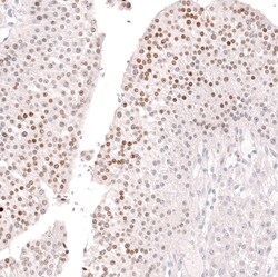 Invitrogen FOXL2 Monoclonal Antibody (CL12762) 100 &mu;L; Unconjugated:Antibodies,