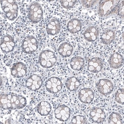 Invitrogen FOXL2 Monoclonal Antibody (CL12762) 100 &mu;L; Unconjugated:Antibodies,