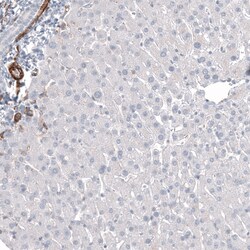 Invitrogen CD146 Monoclonal Antibody (CL12855) 100 &mu;L; Unconjugated:Antibodies,