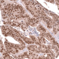 CDX2 Monoclonal Antibody (CL12967), Invitrogen 100 &mu;L; Unconjugated:Antibodies,