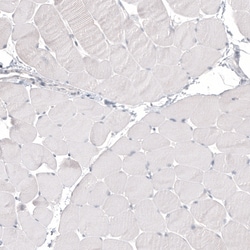CDX2 Monoclonal Antibody (CL12967), Invitrogen 100 &mu;L; Unconjugated:Antibodies,