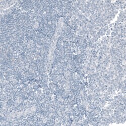 CDX2 Monoclonal Antibody (CL12967), Invitrogen 100 &mu;L; Unconjugated:Antibodies,
