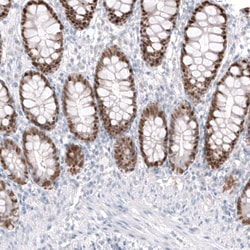 Invitrogen CDX2 Monoclonal Antibody (CL12967) 100 &mu;L; Unconjugated:Antibodies,