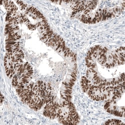 Invitrogen CDX2 Monoclonal Antibody (CL12967) 100 &mu;L; Unconjugated:Antibodies,