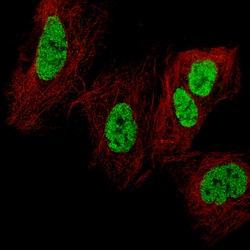 Invitrogen CDX2 Monoclonal Antibody (CL12974) 100 &mu;L; Unconjugated:Antibodies,