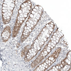 Invitrogen CDX2 Monoclonal Antibody (CL12974) 100 &mu;L; Unconjugated:Antibodies,