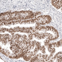 Invitrogen CDX2 Monoclonal Antibody (CL12974) 100 &mu;L; Unconjugated:Antibodies,