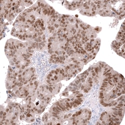 Invitrogen CDX2 Monoclonal Antibody (CL12974) 100 &mu;L; Unconjugated:Antibodies,